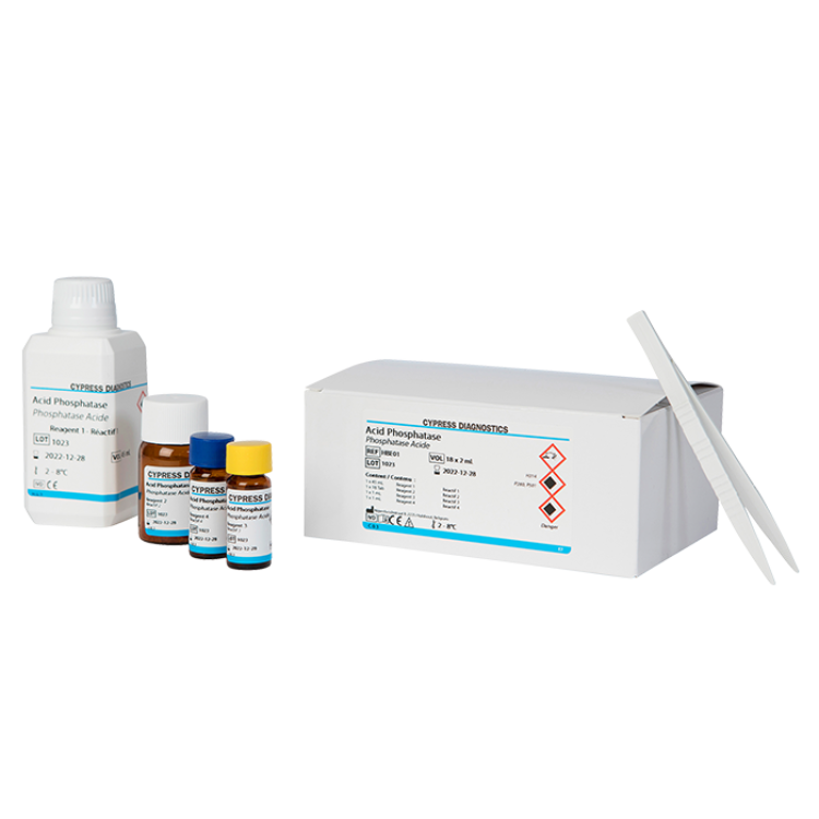 Acid Phosphatase  (Kislota fosfataza)